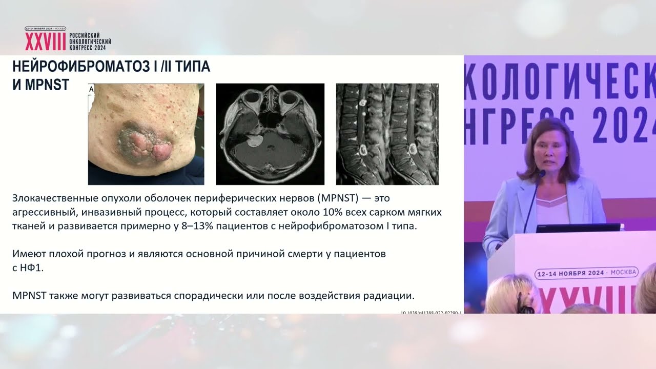 Шваннома