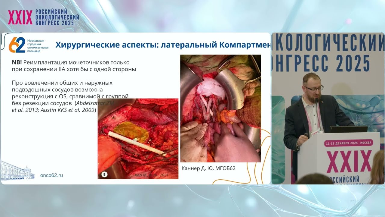 Концепция «следующего слоя» в хирургии обширных опухолей таза 