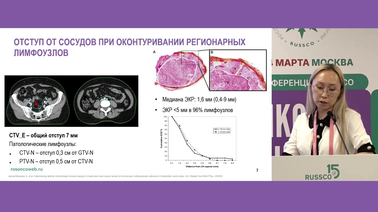 Точка невозврата II: где ошибка в выборе объемов превращает план в географический промах