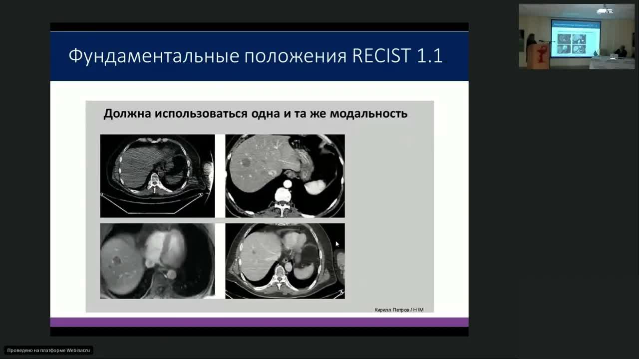 Как правильно оценить эффект иммунотерапии?