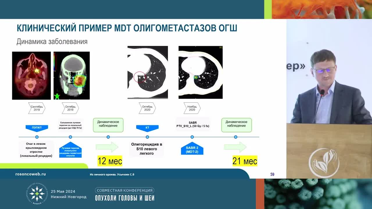 Олигометастазы опухолей головы и шеи: взгляд радиотерапевта