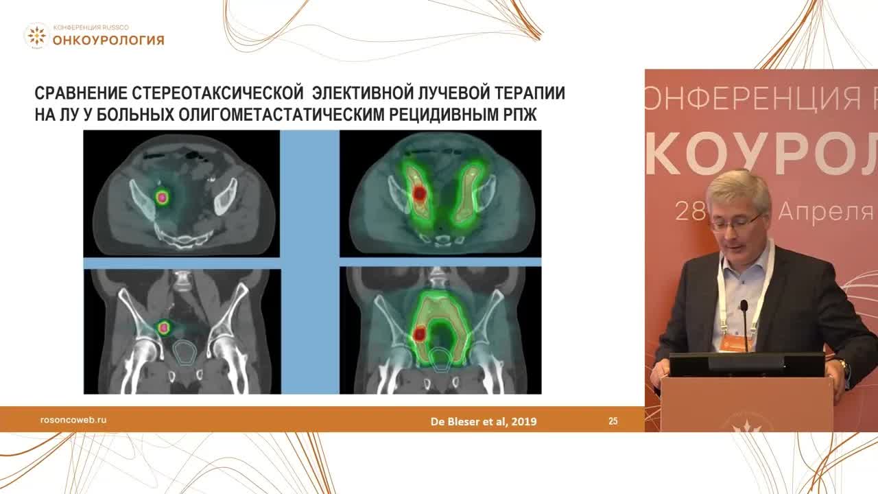 Особенности селекции пациентов для метастаз-направленной терапии при олигометастатическом РПЖ. Можем ли обойтись без системного лечения и когда?