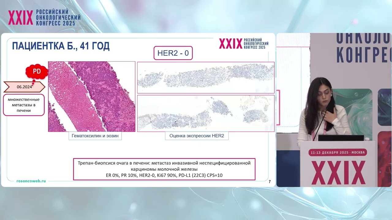 Прецизионная онкология. Анти-HER2 терапия при HER2-негативных метастазах РМЖ