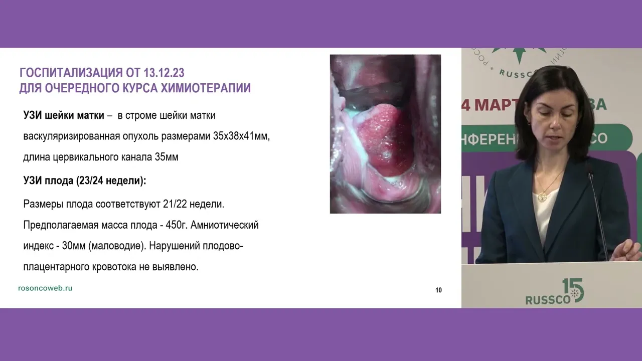 Лечение беременной пациентки с РШМ в руках федерального центра