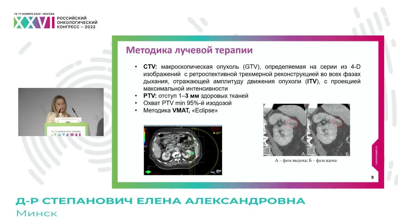Стереотаксическая лучевая терапия при раке почки