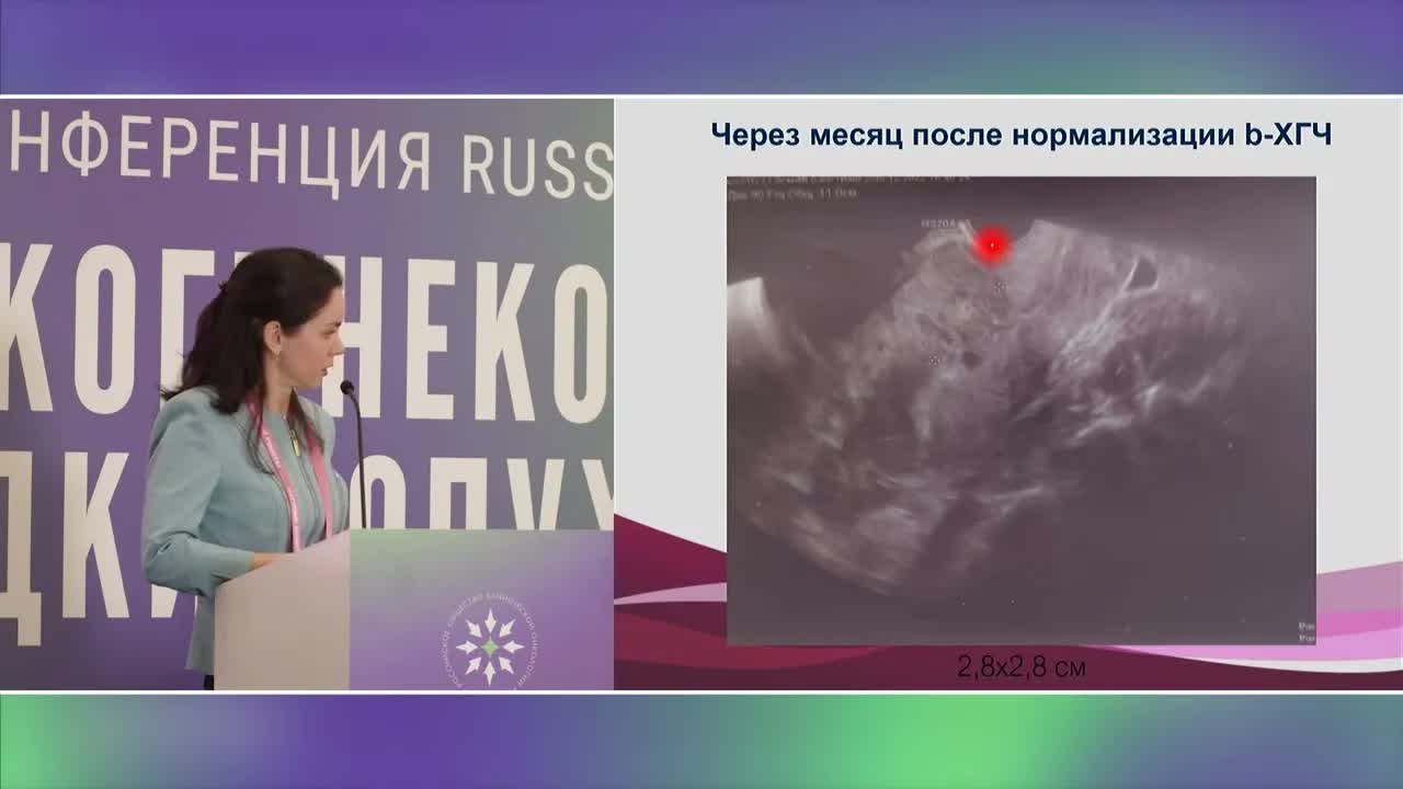 Лечение трофобластических опухолей матки. Клинический случай 1
