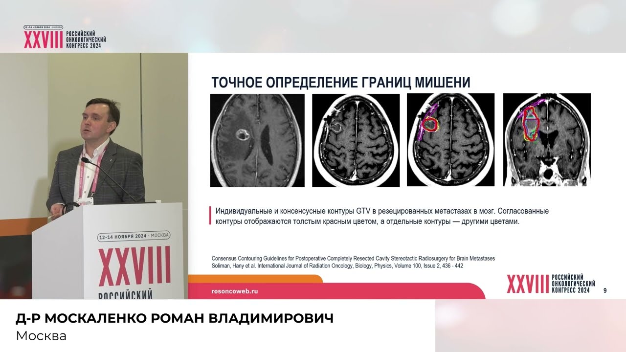 SBRT: искусство или ремесло?