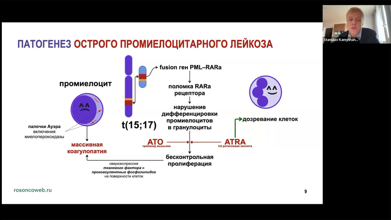 Академия RUSSCO к экзамену ESMO: Острый лейкоз и миелодиспластический синдром (5 октября 2025)