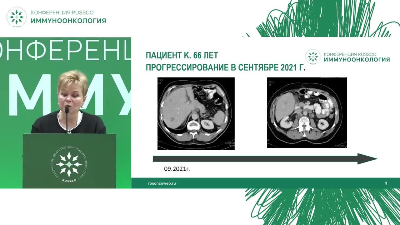 Иммуноонкология. Опухоли ЖКТ. Комментарии эксперта