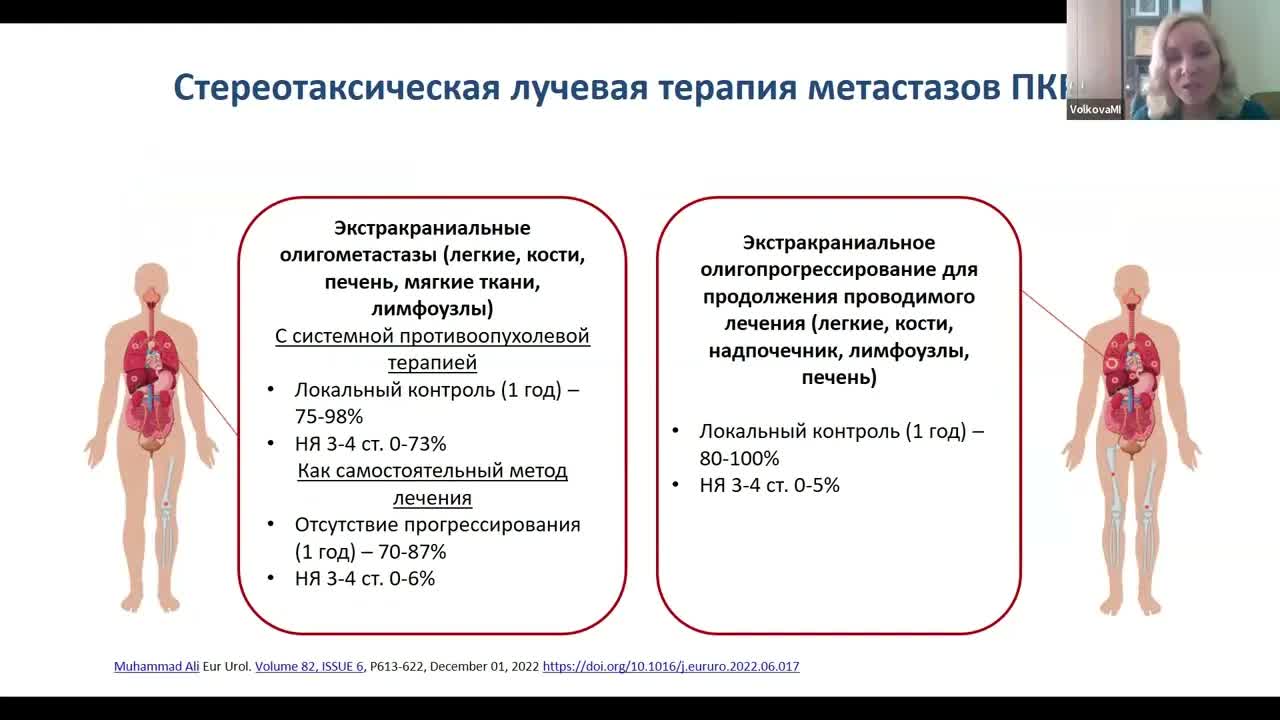 Онкоурология (вебинар 9 сентября 2024)