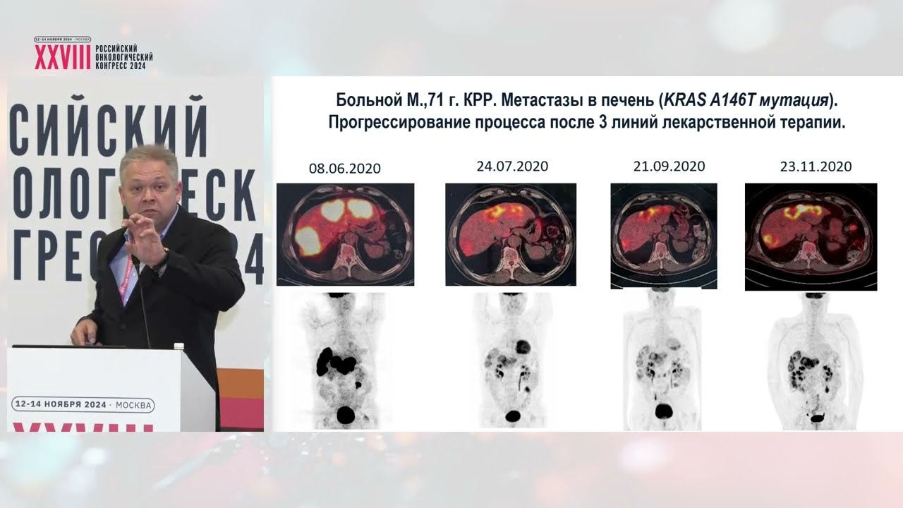 Метаболические особенности злокачественных опухолей: есть ли место в клинической практике?