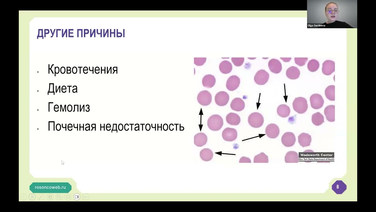 Академия RUSSCO для подготовки к экзамену ESMO: Анемия. Тромбоцитопения (вебинар 31 августа 2025)