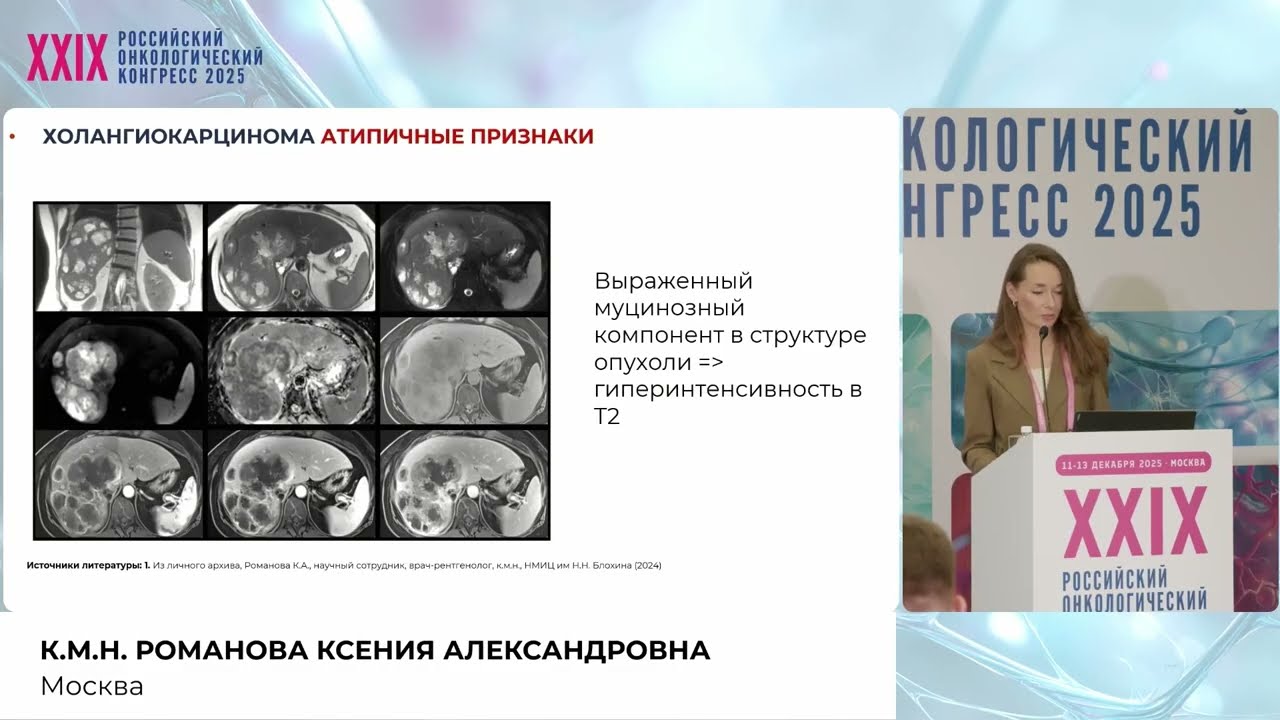 Особенности лучевой диагностики внутрипеченочной холангиокарциномы 