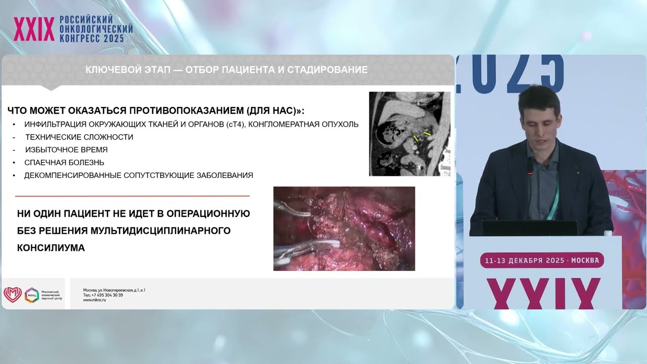 Лапароскопическая хирургия рака желудка