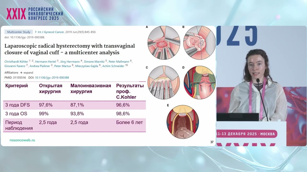 Исследование LACC: лапароскопическая и открытая радикальная гистерэктомия при раке шейки матки