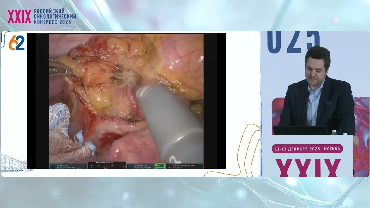 Резектабельный рак пищевода и желудка. MIE