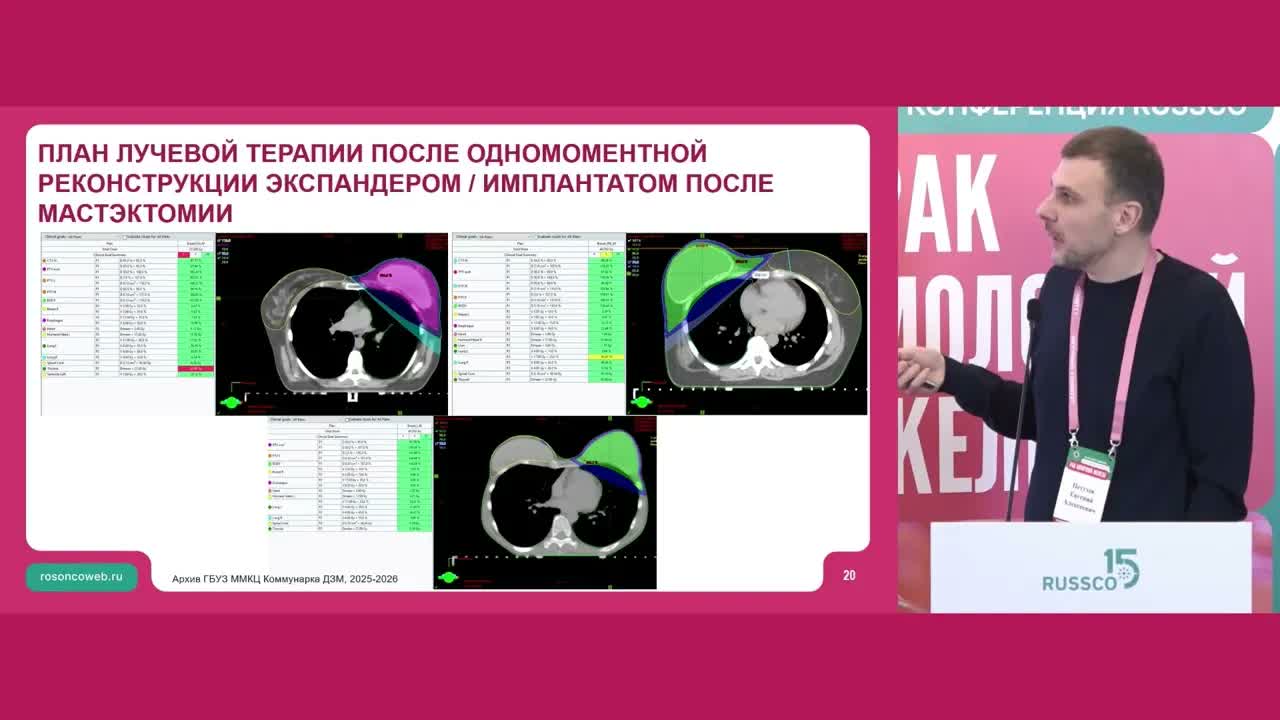 Лучевая терапия РМЖ после подкожной мастэктомии и мтс в 1-м л/узле: ПРОТИВ