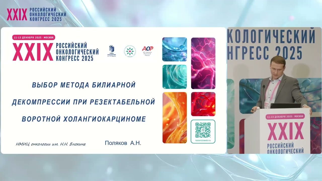 Выбор метода билиарной декомпрессии при резектабельной воротной холангиокарциноме