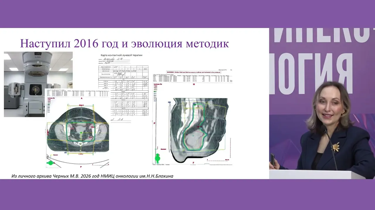От FIGO до IMRT и брахитерапии: где мы можем потерять контроль и как этого не допустить