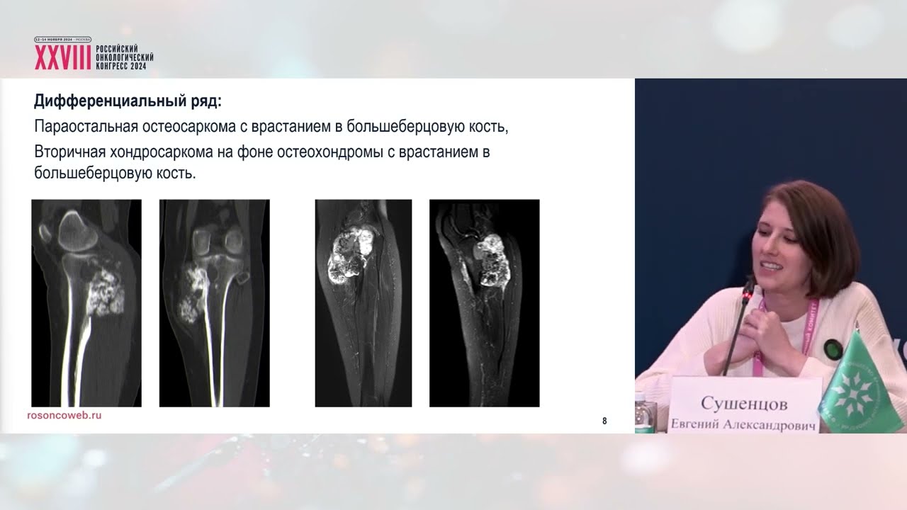 Расхождение морфологического и рентгенологического диагноза