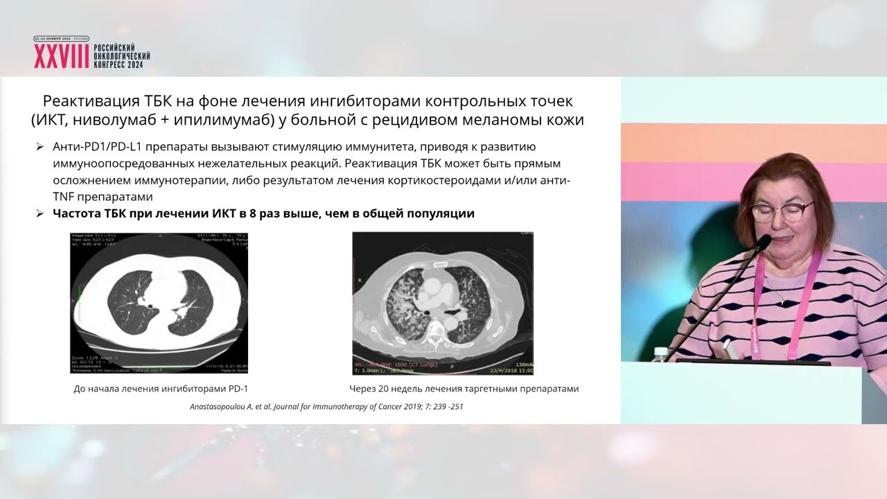 Что надо знать о редко встречающихся возбудителях инфекций у онкологических больных