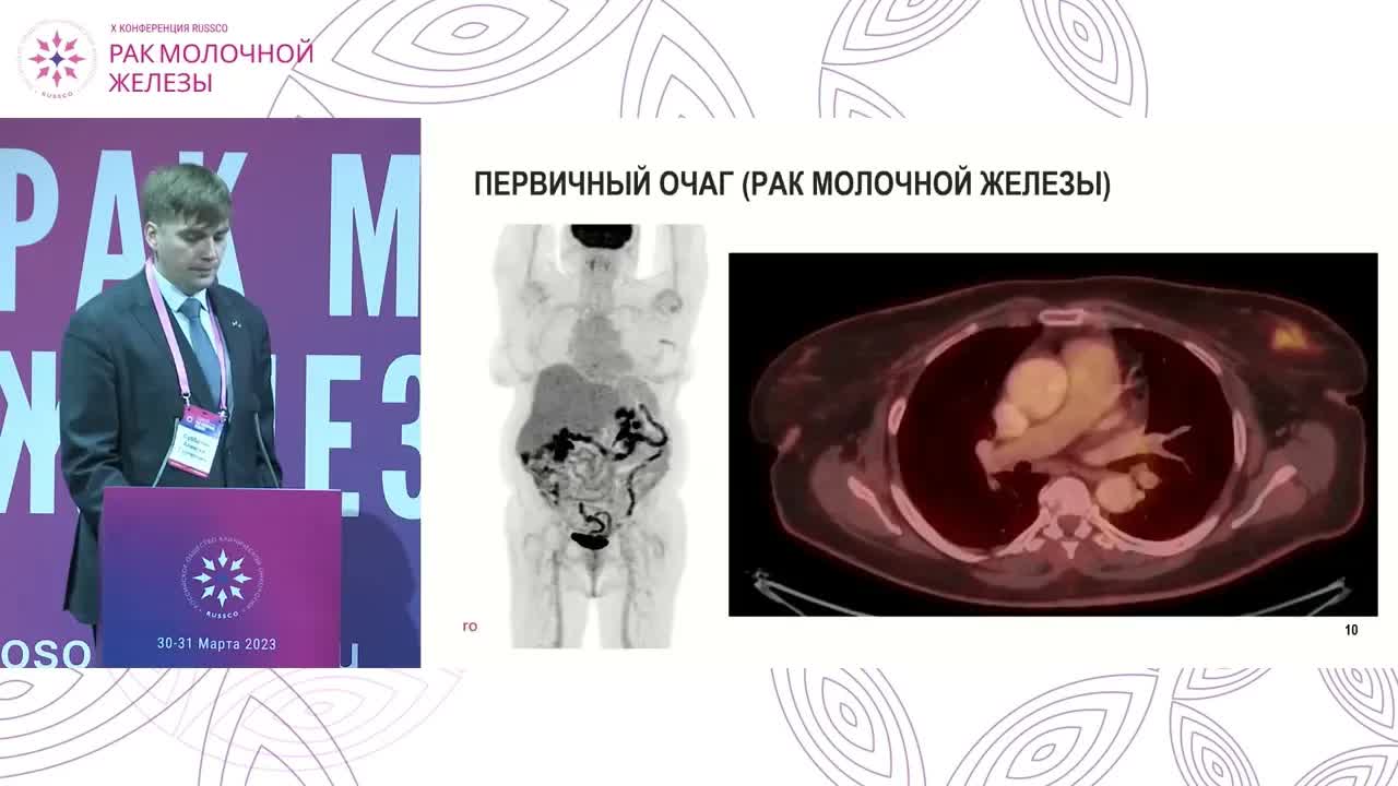 Обзор возможностей ПЭТ-КТ, роль различных вариантов при РМЖ