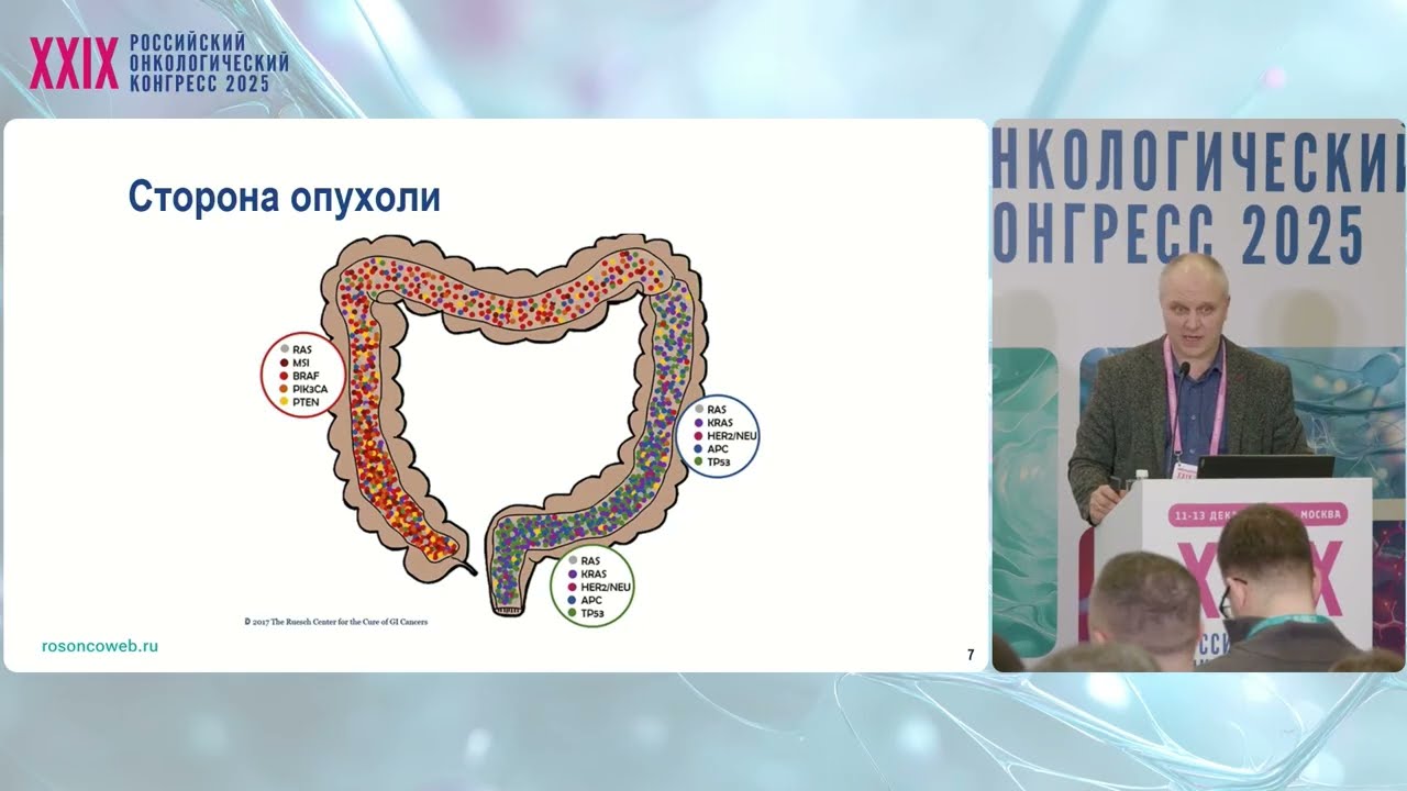 Выбор противоопухолевой терапии у пациентов с метастазами КРР в печени. Международные исследования