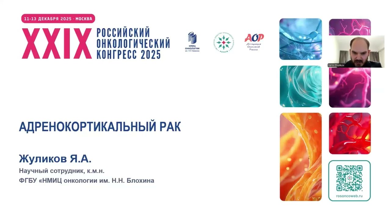 Адренокортикальный рак