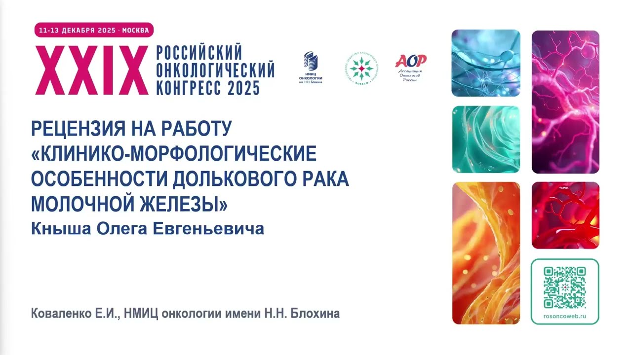 Клинико-морфологические особенности долькового рака молочной железы. Рецензент